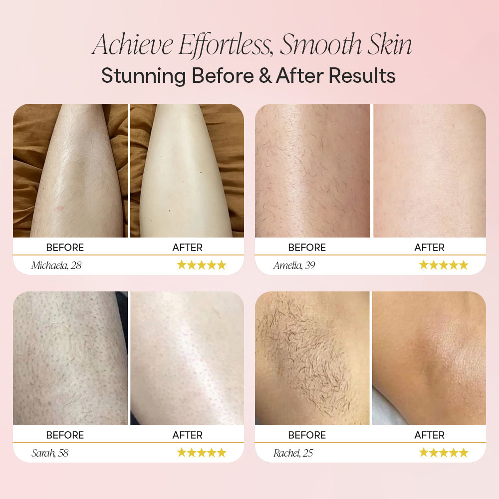 Alvora™ Trimmer 2.0